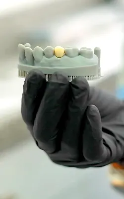 img-implantes-dentales-en-medellin-1-LCP