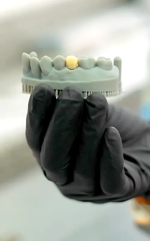 img-implantes-dentales-en-medellin-1