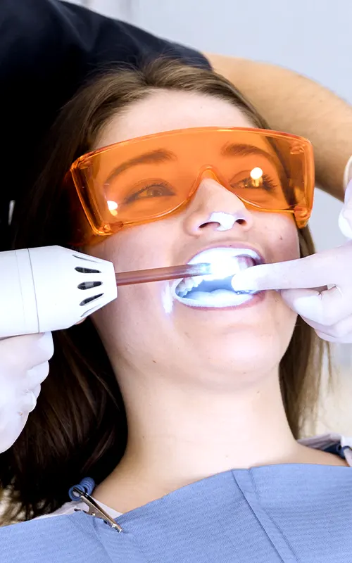 img-teeth-whitening-medellin-1